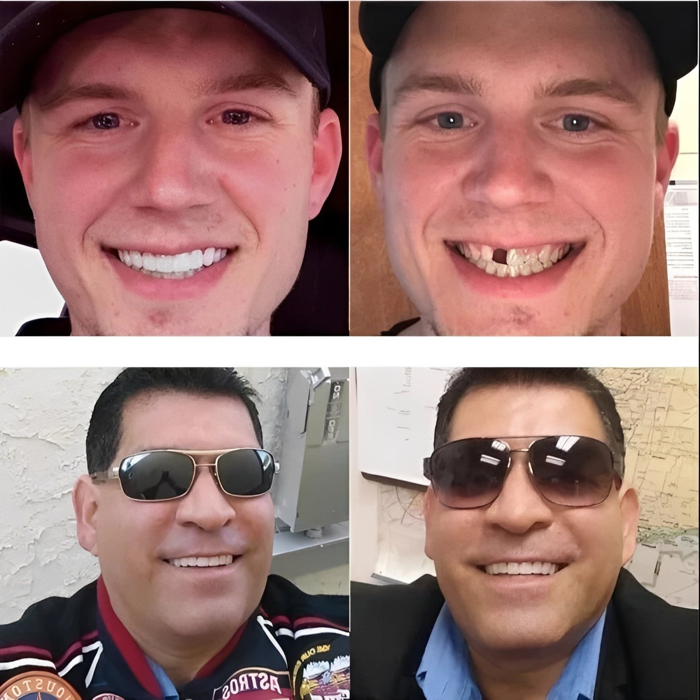 Customizable Smile Enhancer with Secure Fit