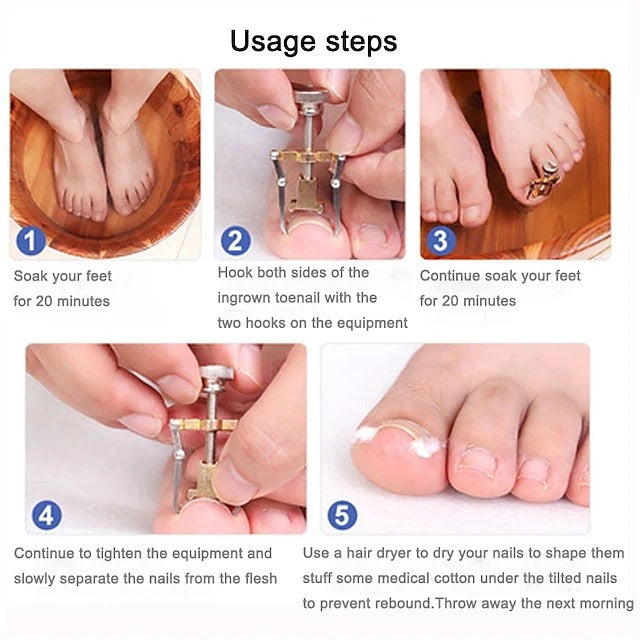 Dual Stainless Steel Toenail Straightening Tool Set for Home Care