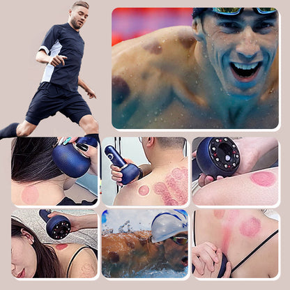 Cupping Set Electric Heating Adjustable 9 Intensity Levels