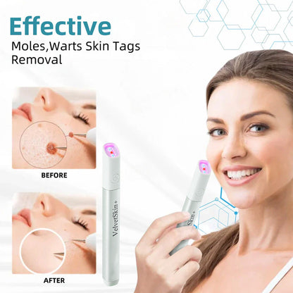 Skin Laser Pen Micro-Focused CO2 Handheld