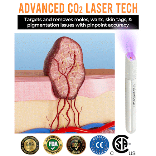 Skin Laser Pen Micro-Focused CO2 Handheld