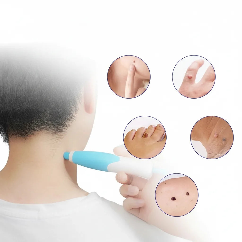 Skin Spot Remover Kit Pain-Free Silicone Bands Two Sizes
