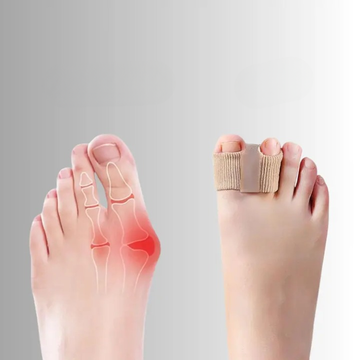 Toe Aligner Soft Silicone Gel Pain Relief Two Pairs