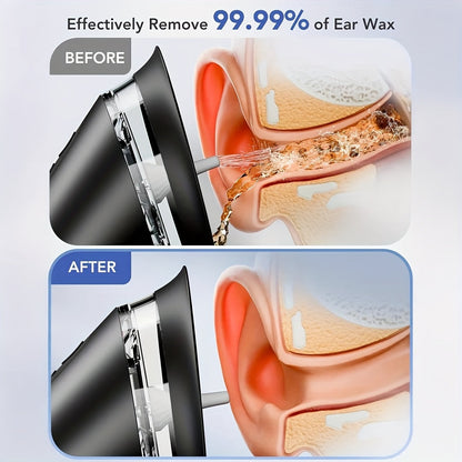 Gentle Ear Care System with Adjustable Water Pressure