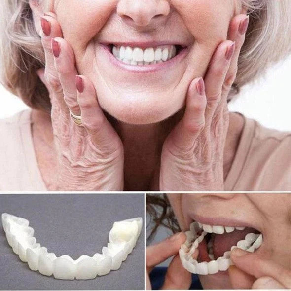 QuickSmile Complete Veneer Set for Upper and Lower Teeth