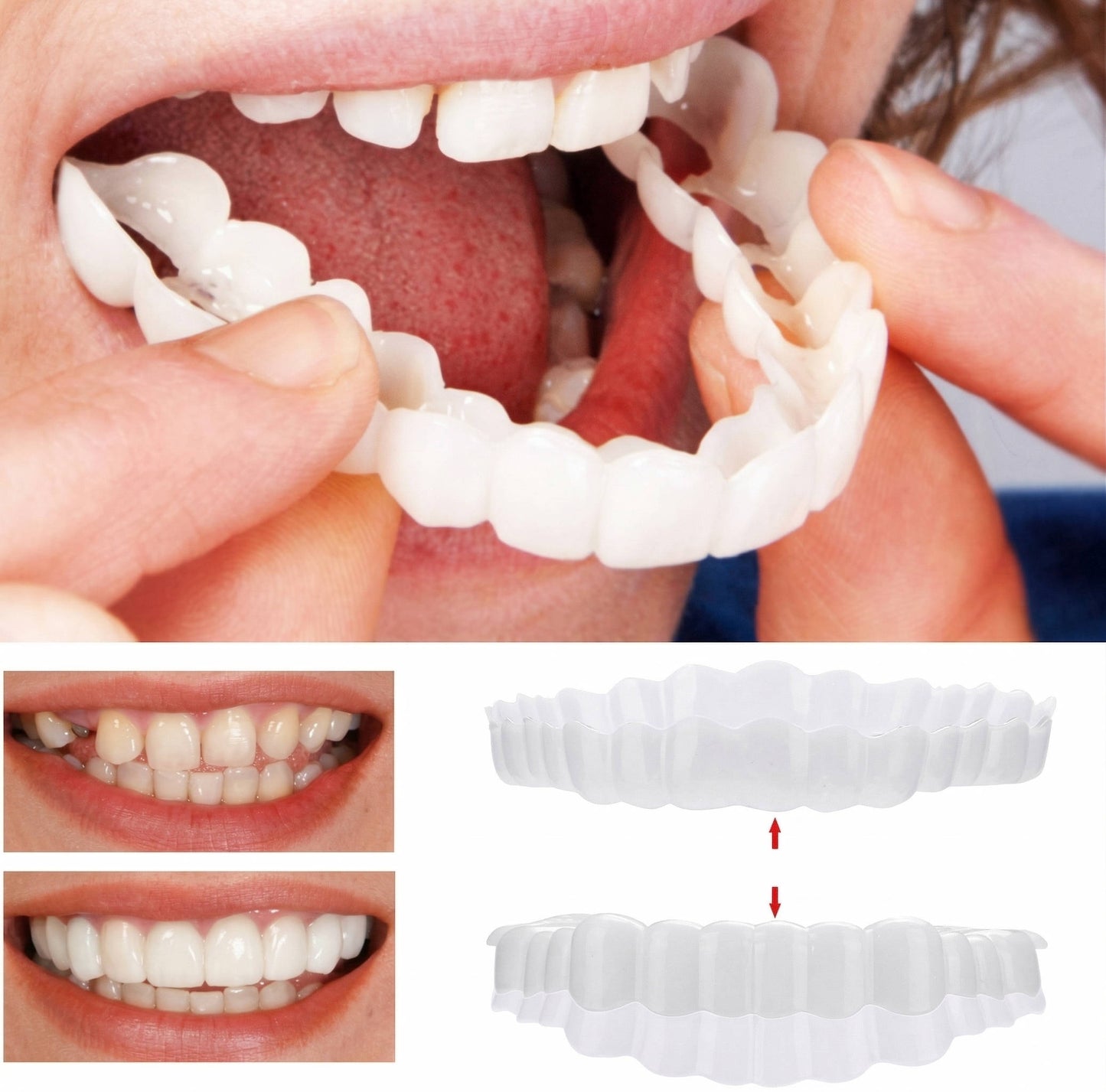 Instant Smile Enhancement Kit for Top and Bottom Teeth