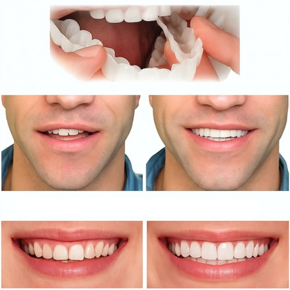 Instant Smile Enhancer with Adjustable Fit in Bright White