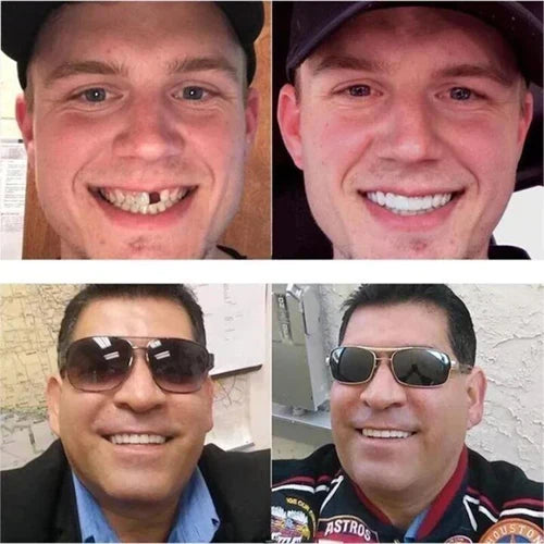 Instant Smile Enhancer with Adjustable Fit in Bright White