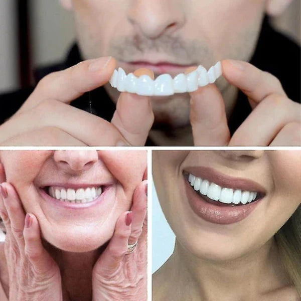 Instant Smile Enhancer with Adjustable Fit in Bright White