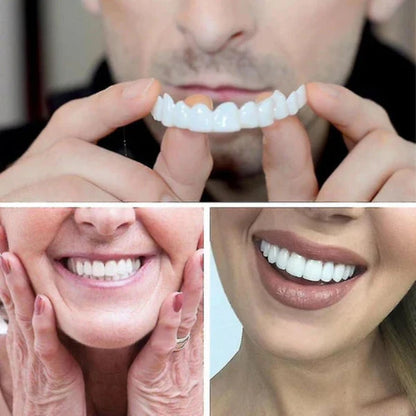 Instant Smile Enhancer with Adjustable Fit in Bright White