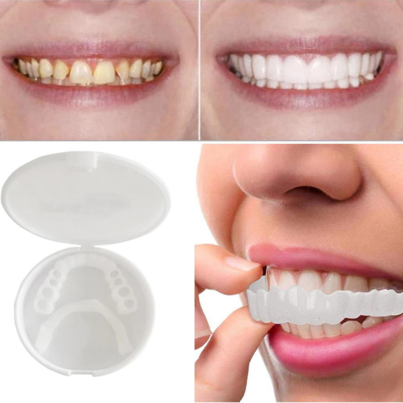 Custom Fit Temporary Tooth Cover for Instant Confidence