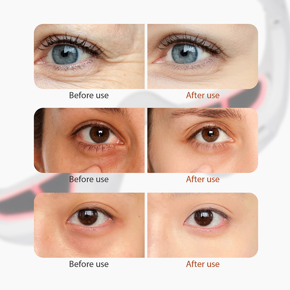 Soothing Eye Relaxer with LED Light and Versatile Settings