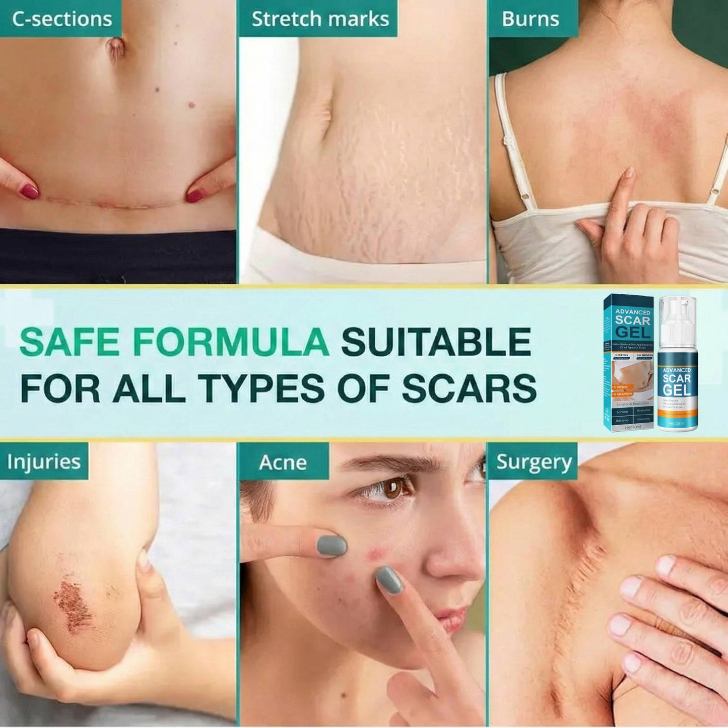 Revitalizing Silicone Cream for Scars and Skin Hydration