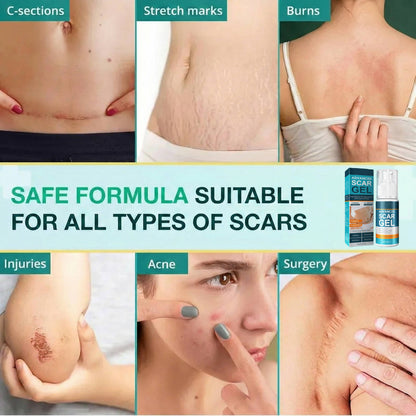Revitalizing Silicone Cream for Scars and Skin Hydration