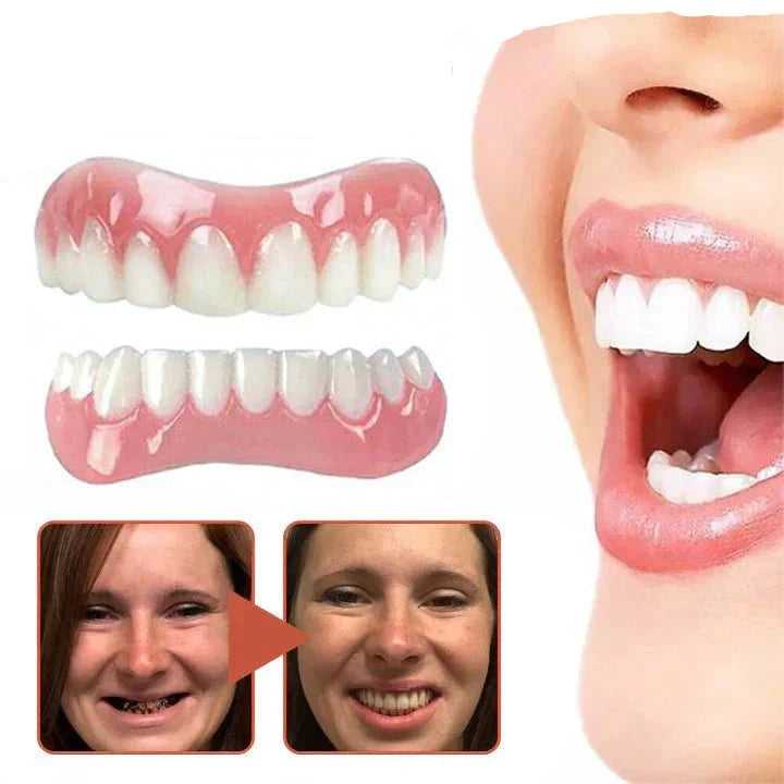Custom-Fit Silicone Smile Enhancer for a Confident Look