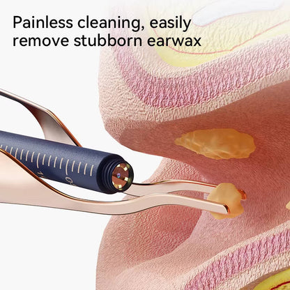 Smart Ear Hygiene Tool with HD Camera and Travel Case