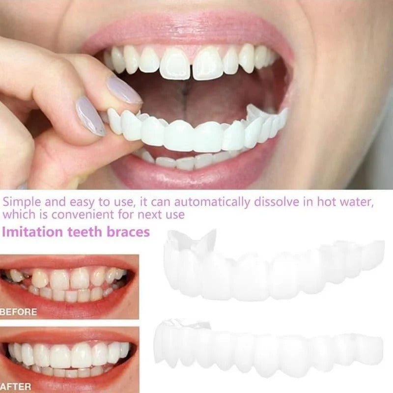 Instant Smile Enhancer Set for Upper and Lower Teeth
