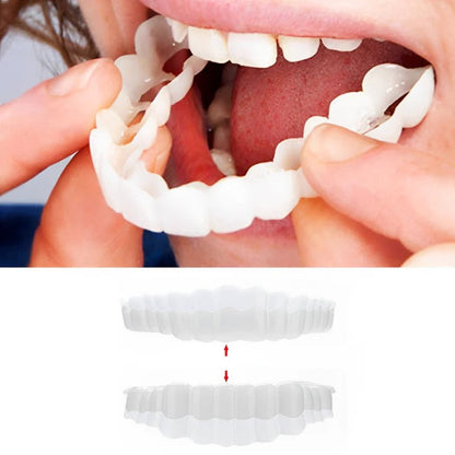 Snap-On Smile Enhancer for Ultimate Confidence