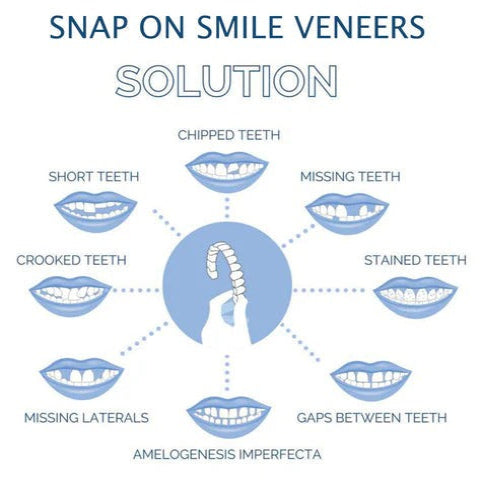 Snap-On Smile Enhancer for Ultimate Confidence