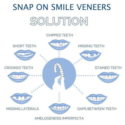 Snap-On Smile Enhancer for Ultimate Confidence