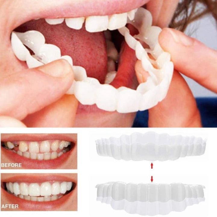 Snap-On Smile Enhancer for Ultimate Confidence