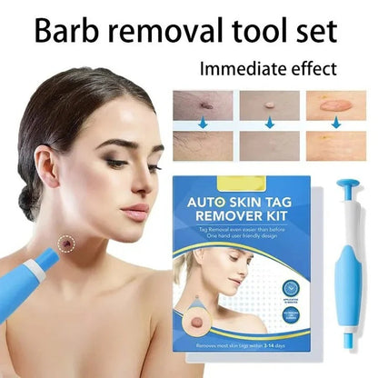 Skin Tag Removal Kit with Easy Applicator and Bands