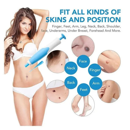 Skin Tag Removal Kit with Easy Applicator and Bands