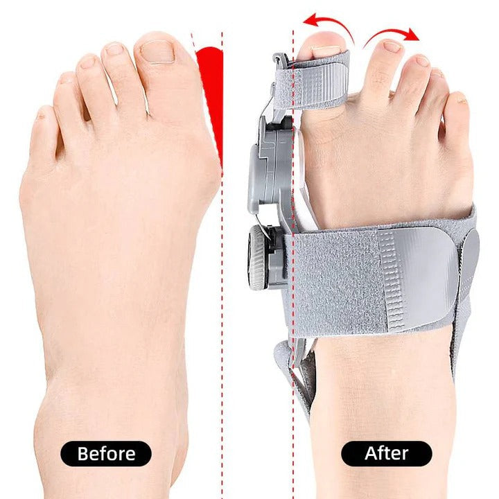 Ergonomic Toe Alignment Support with Adjustable Tension Control