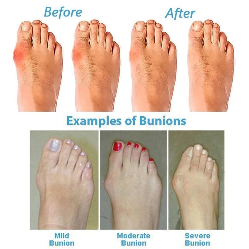 Arch Support Sandals for Enhanced Comfort and Alignment