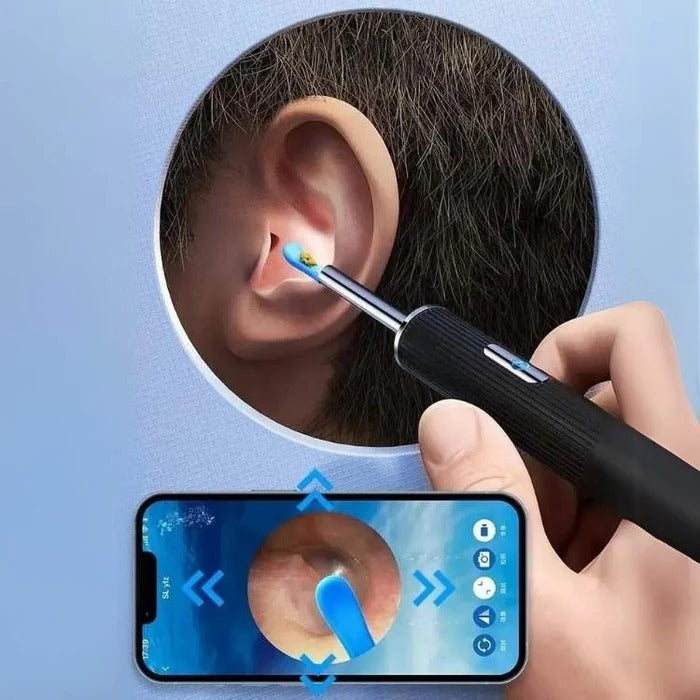 Smart Ear Inspection Tool with Live Camera Feed