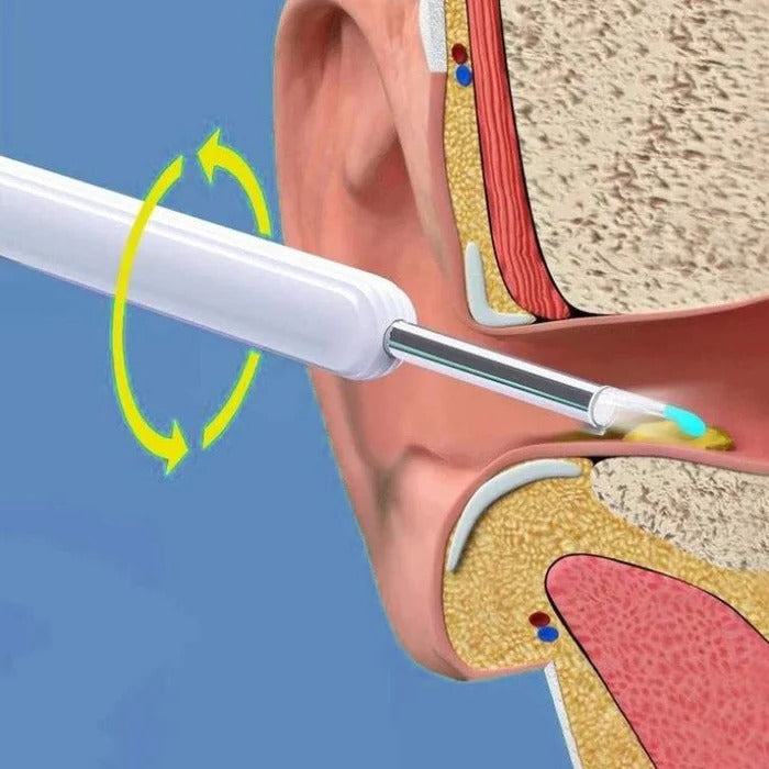 Smart Ear Inspection Tool with Live Camera Feed