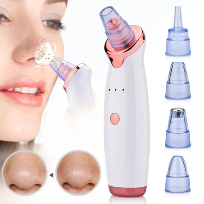 Rechargeable Pore Cleaner with Precision Suction Tip