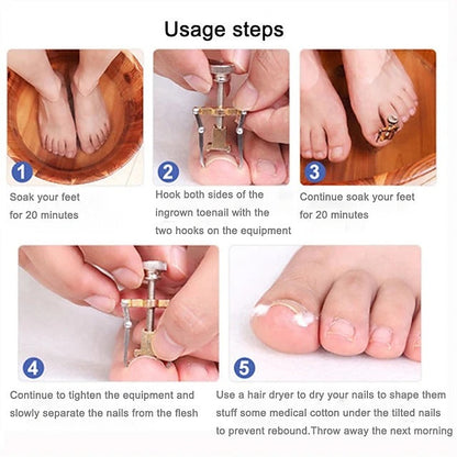 Dual Stainless Steel Toenail Straightening Tool Set for Home Care
