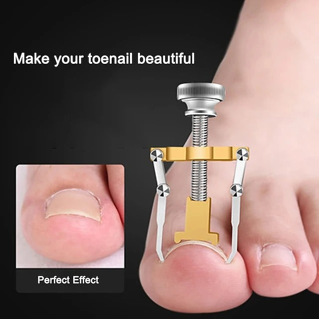 Dual Stainless Steel Toenail Straightening Tool Set for Home Care