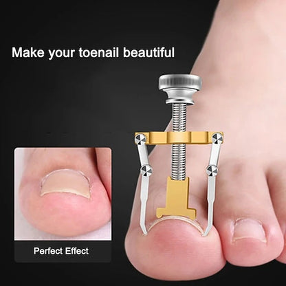 Dual Stainless Steel Toenail Straightening Tool Set for Home Care