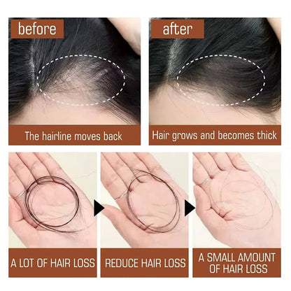 Nourishing Scalp and Hair Oil for Ultimate Hydration