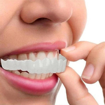 Instant Smile Enhancement Kit for Top and Bottom Teeth