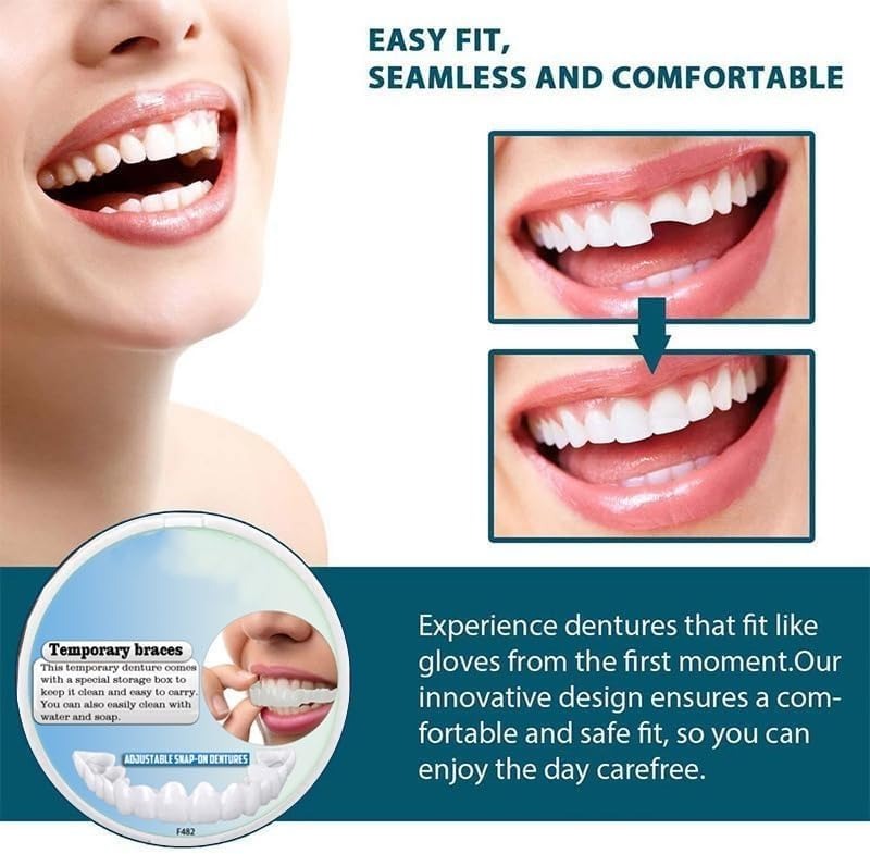Instant Smile Enhancement Kit for Top and Bottom Teeth