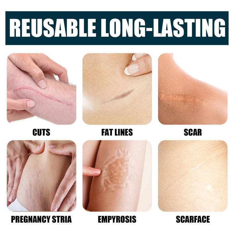 Revitalizing Silicone Cream for Scars and Skin Hydration