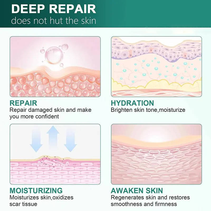 Revitalizing Silicone Cream for Scars and Skin Hydration