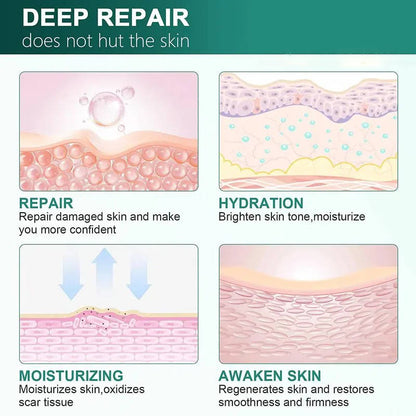 Revitalizing Silicone Cream for Scars and Skin Hydration