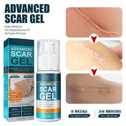 Revitalizing Silicone Cream for Scars and Skin Hydration