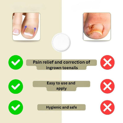Rapid Nail Repair Solution for Ingrown and Damaged Nails