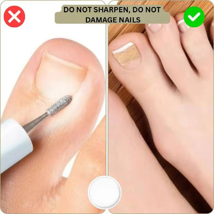 Rapid Nail Repair Solution for Ingrown and Damaged Nails