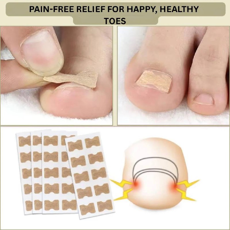 Rapid Nail Repair Solution for Ingrown and Damaged Nails