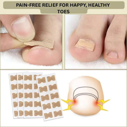Rapid Nail Repair Solution for Ingrown and Damaged Nails