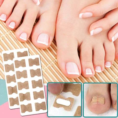 Rapid Nail Repair Solution for Ingrown and Damaged Nails