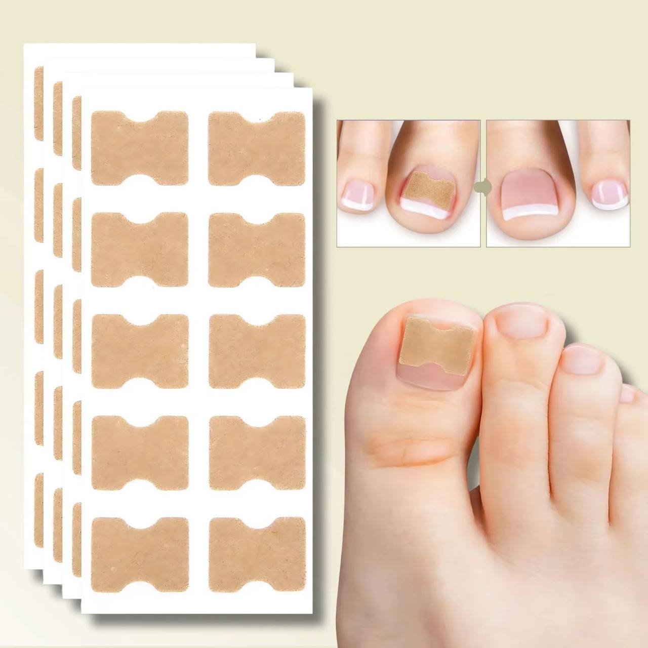 Rapid Nail Repair Solution for Ingrown and Damaged Nails