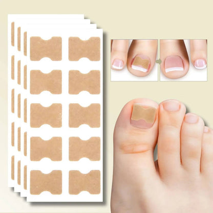 Rapid Nail Repair Solution for Ingrown and Damaged Nails