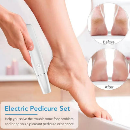 Rechargeable Foot Smoother with LED Guidance and Custom Speeds